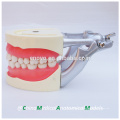 Soft Gum Dental Teaching Modell für Zähne Vorbereitung Training 13010